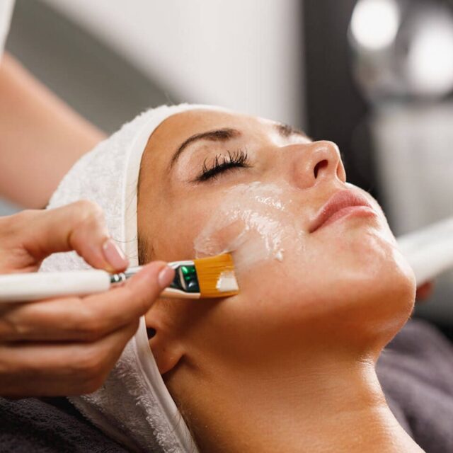 peeling-facial-en-malaga-3-944x1024